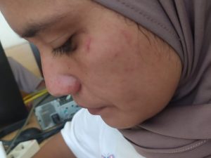 Orang tua Siswa Diduga Ngamuk dan Aniaya Guru SDN 13 Paguat